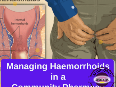 MANAGING HAEMORRHOID IN A COMMUNITY PHARMACY