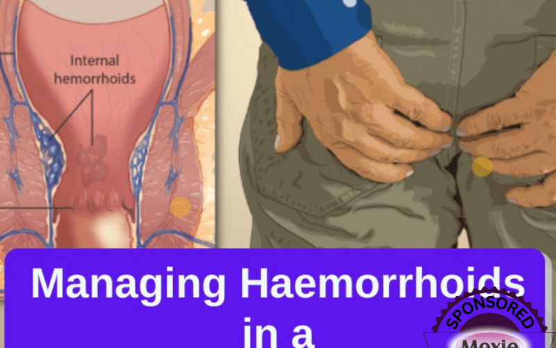 MANAGING HAEMORRHOID IN A COMMUNITY PHARMACY