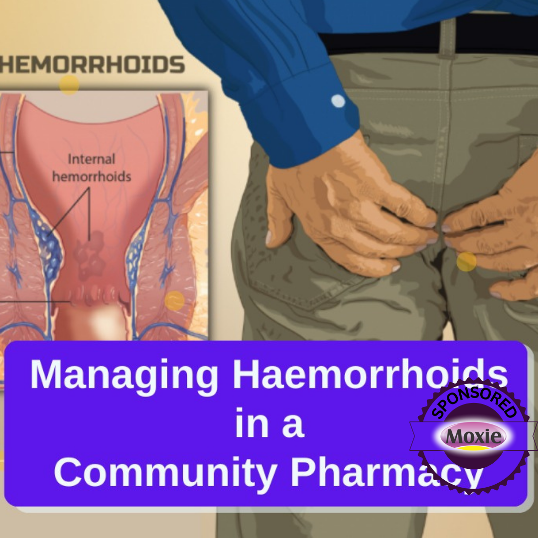 MANAGING HAEMORRHOID IN A COMMUNITY PHARMACY – Pharmacademy